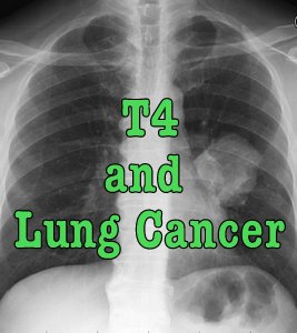 t4 cancer only synthroid lung thyroid madness stop treatment study symptoms slew continuing revealed hypothyroid worldwide patient experience results after