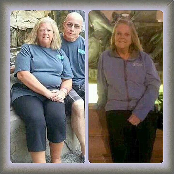 Before After Vicky
