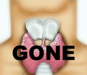 Thyroid is Missing From Human Throat