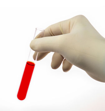 Lab work