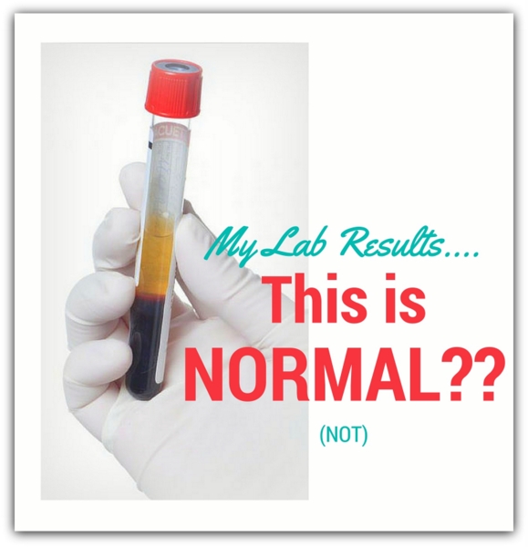 How do you interpret a thyroid test?