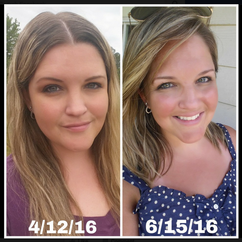 Hypothyroid In Photos Before And After Stop The Thyroid Madness hypothyroid-in-photos-before-and-after-stop-the-thyroid-madness